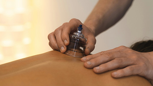 Cupping.jpg