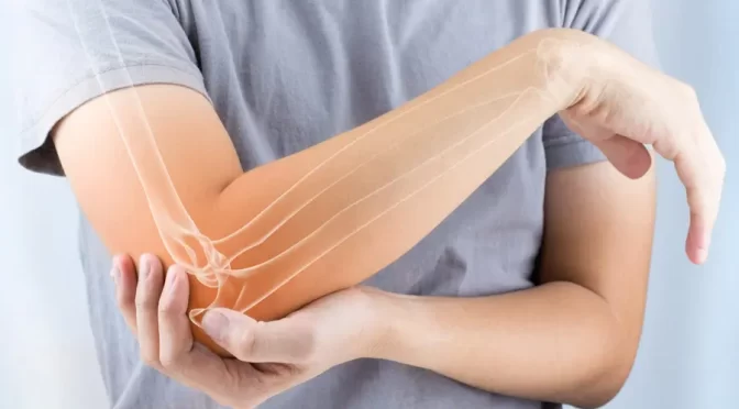 Tennis/Golfer Elbow